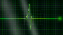 Diploma in ECG Physiology & Analysis with Quiz - Level 2