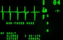 Electrocardiogram (EKG / ECG)