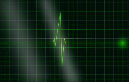 Diploma in ECG Physiology & Analysis with Quiz - Level 2